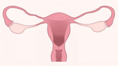 Mitul Menopauzei | Despre fibromul uterin