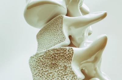 Alimentul care te scapa de osteoporoza