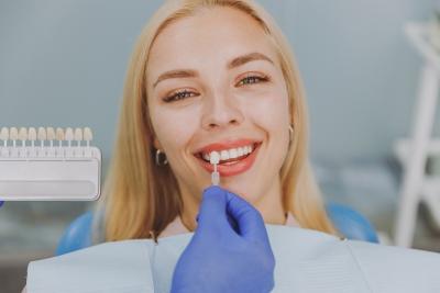 Fatete dentare: Procedura, beneficii, costuri