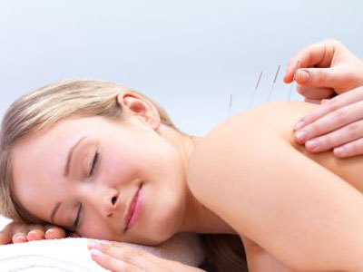 Acupunctura: o terapie alternativa pentru sanatate