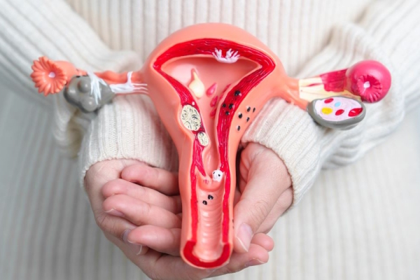 Fibromul uterin: cauzele aparitiei, diagnostic si optiuni de tratament