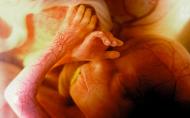 Fecundarea in vitro, asociata cu un risc crescut de nastere a unor bebelusi morti