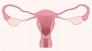 Fibrom uterin la menopauza: la ce sa fii atenta